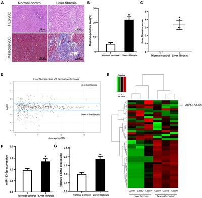 Effect of miR-183-5p on Cholestatic Liver Fibrosis by Regulating Fork Head Box Protein O1 Expression